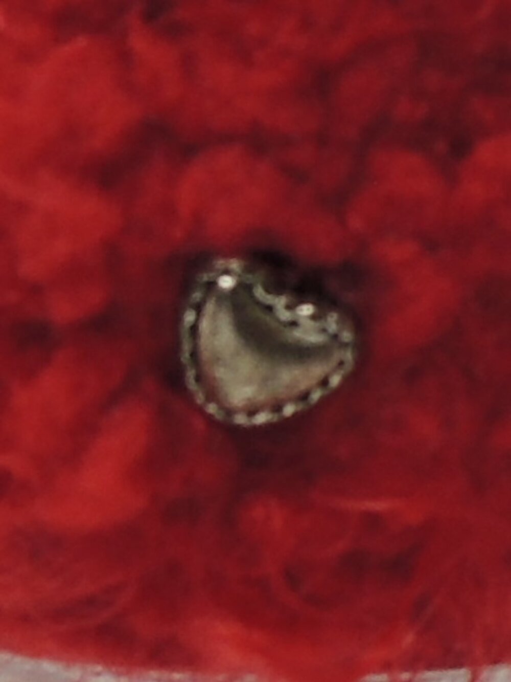 Buttfreckle - Picture 4 of 7